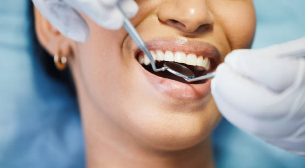Best Emergency Dental Filling Replacement  in Withamsville, OH