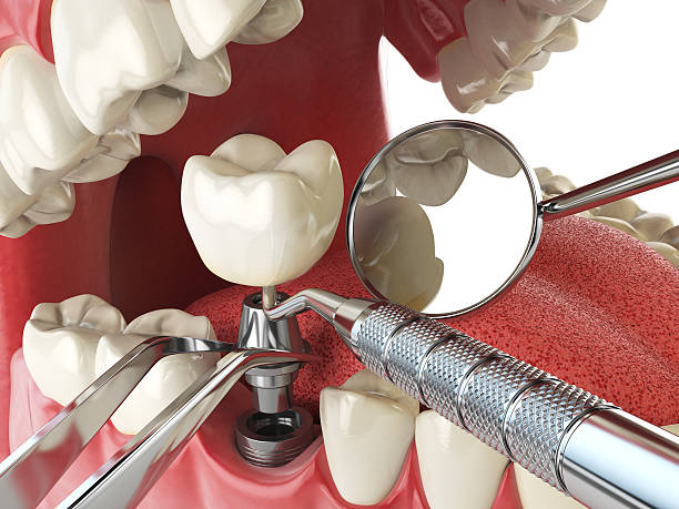 Best Cracked Tooth Emergency Dentist  in Withamsville, OH